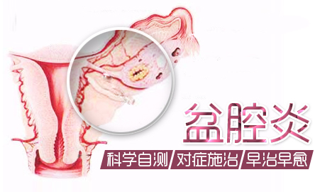 昆明女性确诊盆腔炎需做哪些检查项目？